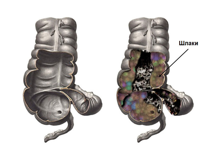 МАРВА ОГАНЯН СМЕРТЬ ИДЕТ ИЗ КИШЕЧНИКА