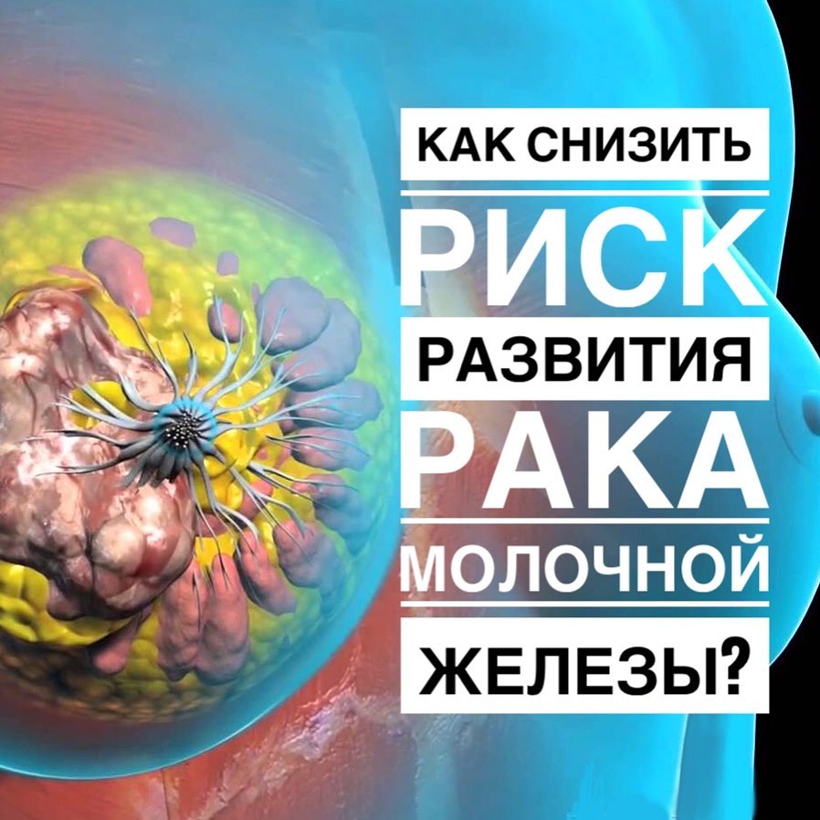 Как снизить риск возникновения рака молочной железы