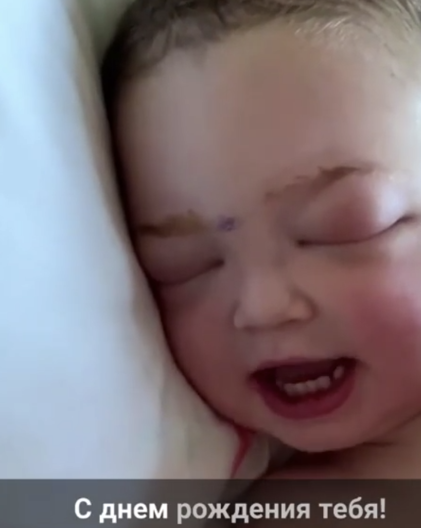 Поет после операции