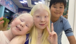 Казахские белоснежки: Как живут девочки-альбиносы из Актау сейчас?