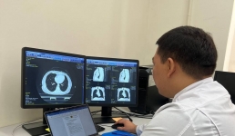 В Мангистау за четыре часа предраковое состояние выявили у 21 женщины