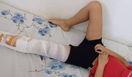 Ушибы и перелом: в Мангистау сверстники избили 8-летнего школьника