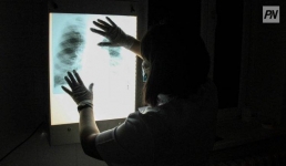 Павлодарцы смогут бесплатно провериться на рак легких