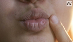 Павлодарка отсудила деньги за некачественное увеличение губ