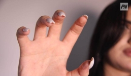 В Павлодаре студентку избили до сотрясения мозга