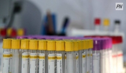 Где в Павлодарской области чаще гриппуют