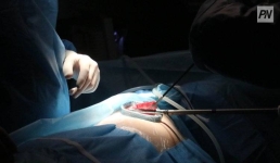 Сколько казахстанцев пролечились за рубежом за счет государства