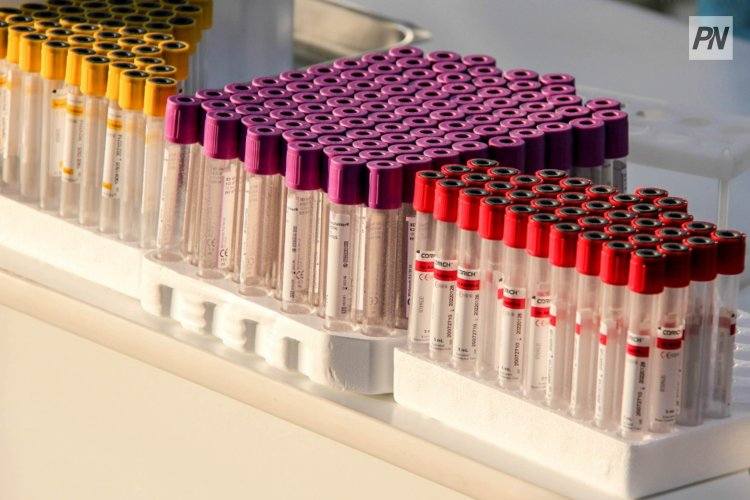 В Павлодарской области стартовала компания по профилактике ВИЧ