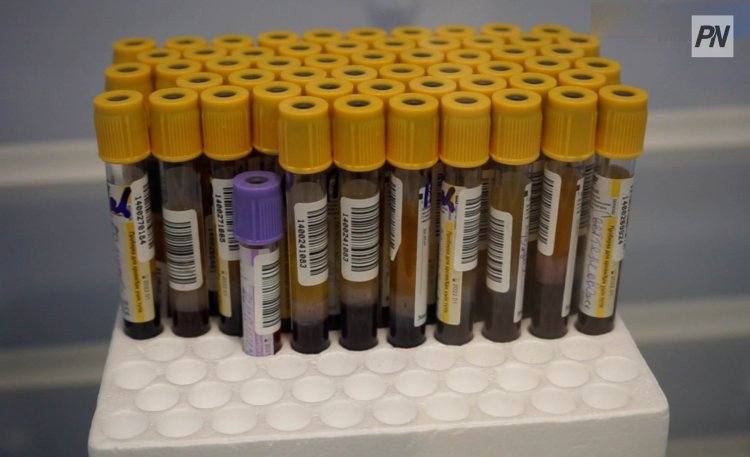 Уровень онкозаболевамости в Павлодарской области сравнили с российским