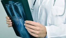 «Мучилась четыре года». Павлодарские врачи прооперировали пациентку с гемангиомой